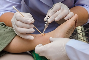Poor Immune Response and Diabetic Wound Healing