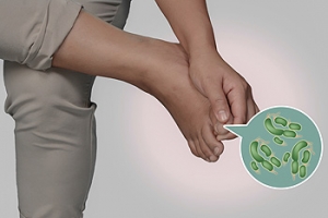 Treating Fungal Nails with Laser Treatment